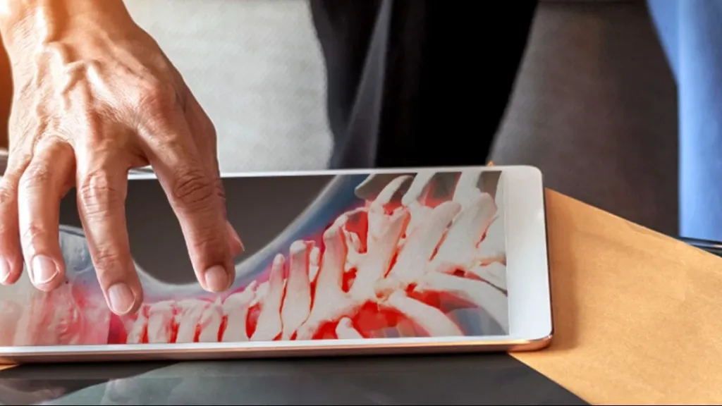 Bone Biologics, which develops solutions for  bone regeneration, is targeting a $3 billion market. / Photo: Bonebiologics.com
