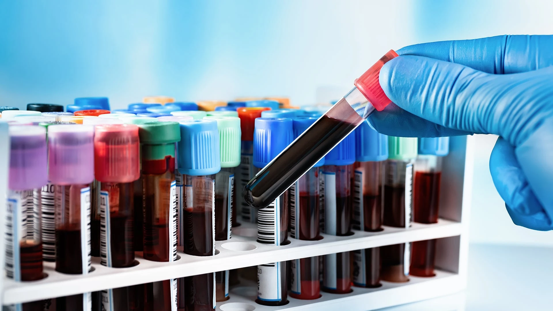 Инвесторы верят в регенеративную медицину / Фото: shutterstock