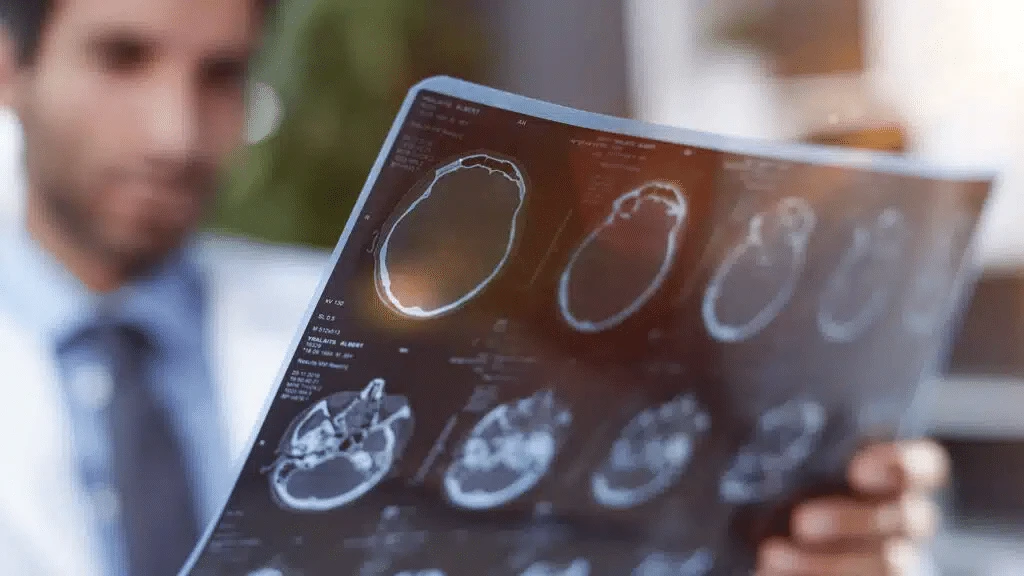 Shares of CNS Pharmaceuticals, a brain cancer treatment developer, continue to plunge / Photo: Shutterstock