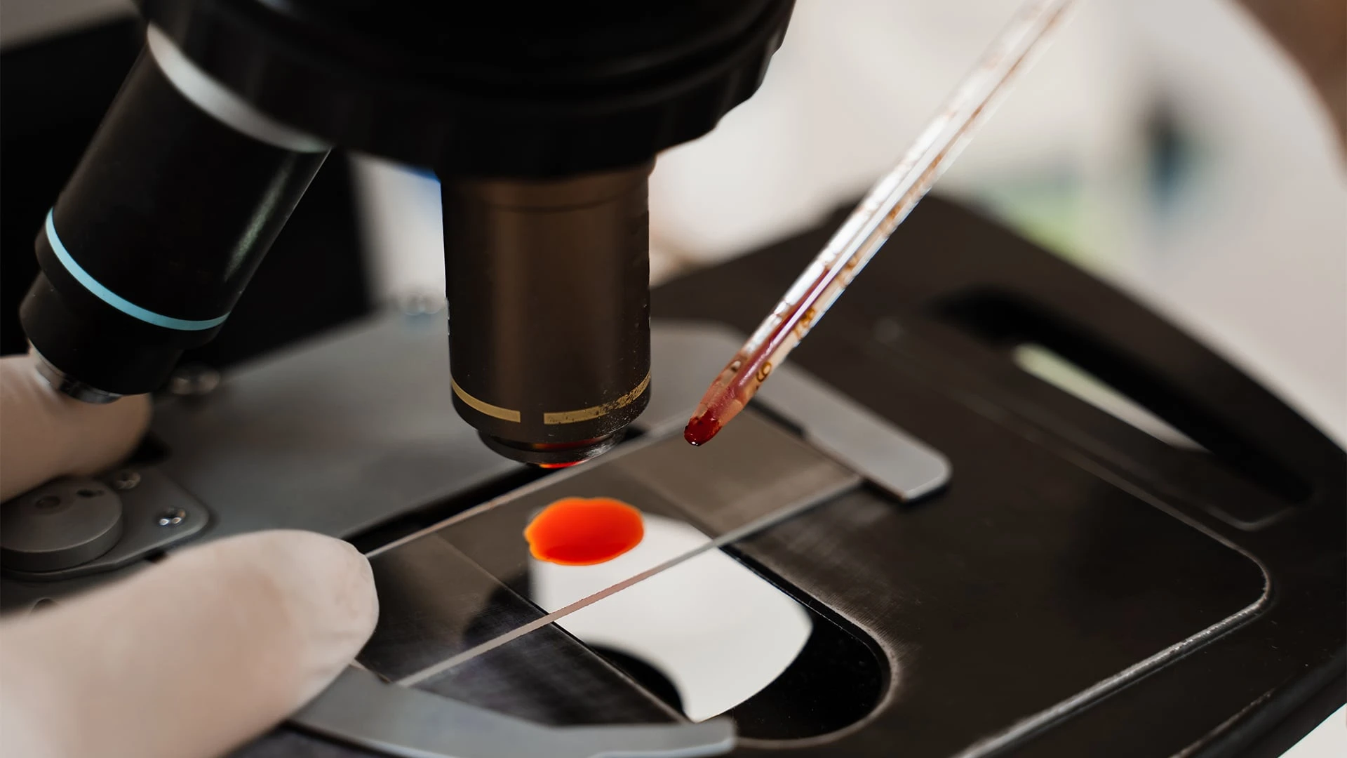 VolitionRx производит тесты для ранней диагностики заболеваний / Фото: Shutterstock