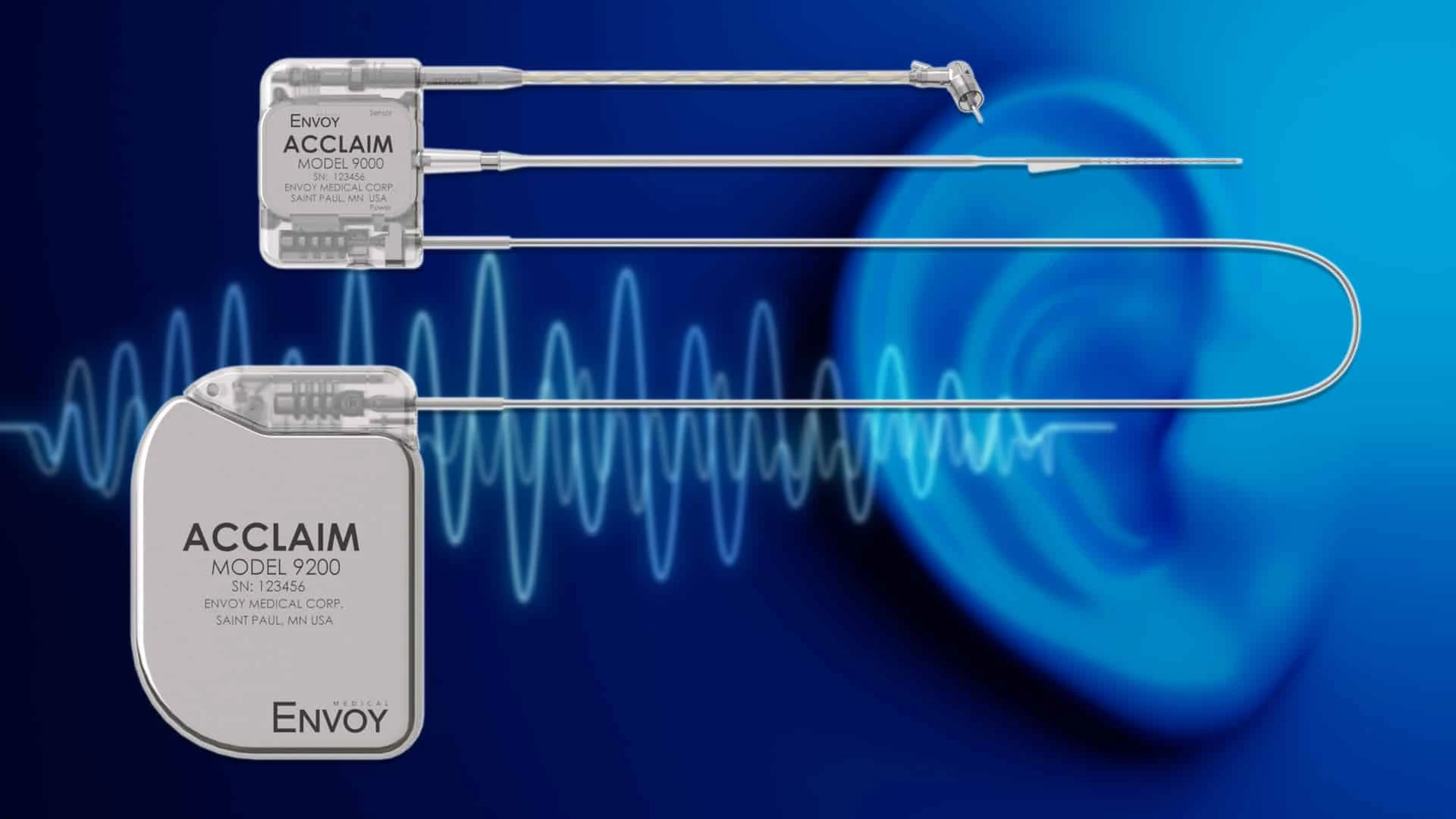 Envoy обещает инвесторам начать испытания кохлеарного импланта / Фото: Envoy Medical