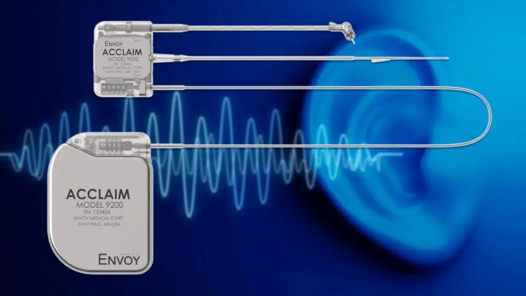 Envoy reported that its cochlear implant was moving forward to a clinical trial / Photo: Envoy Medical