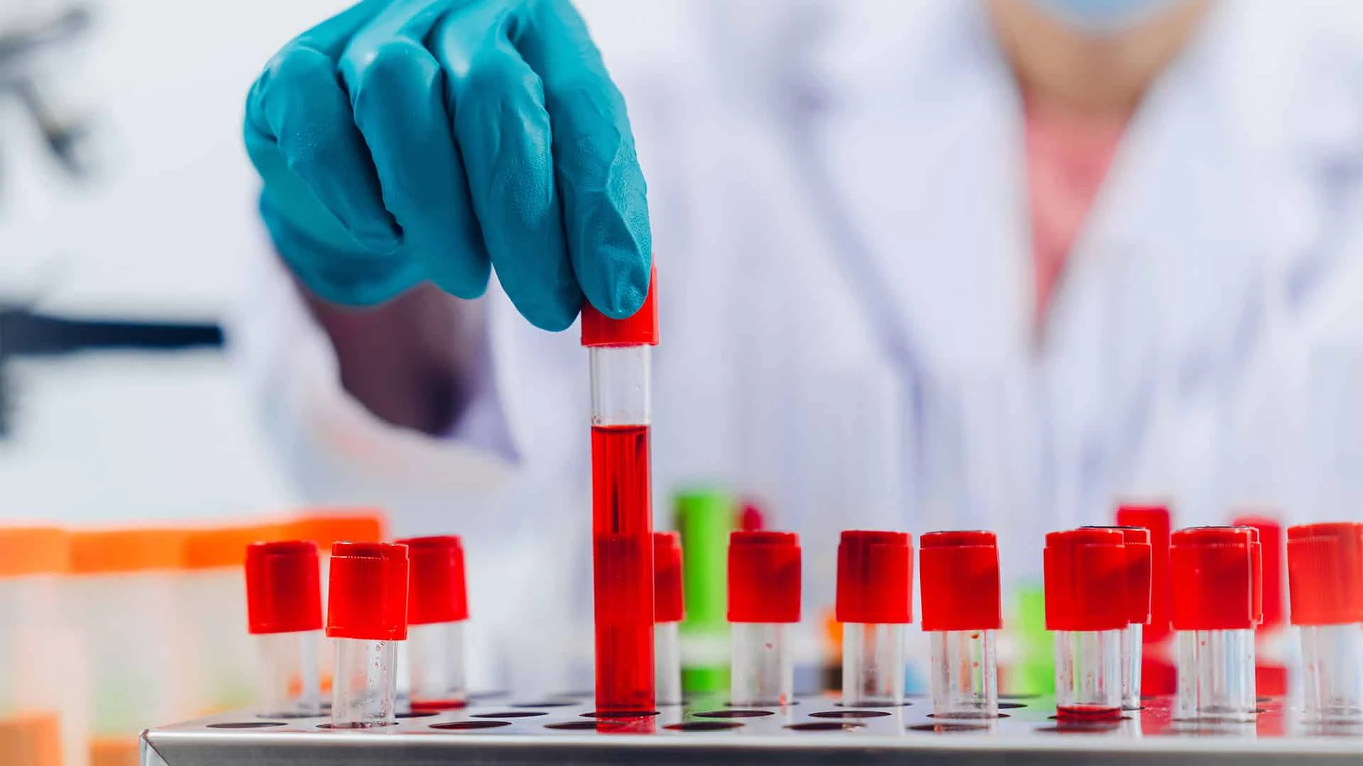 Разработчик методов лечения аутоиммунных заболеваний Zenas BioPharma планирует направить средства от IPO на клинические исследования / Фото: Shutterstock