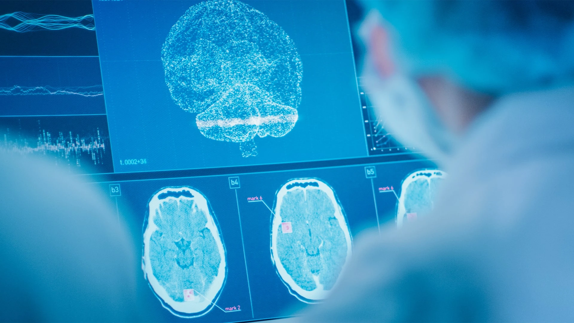 Lundbeck покупает Longboard, чтобы усилить позиции в терапии болезней мозга / Фото: shutterstock