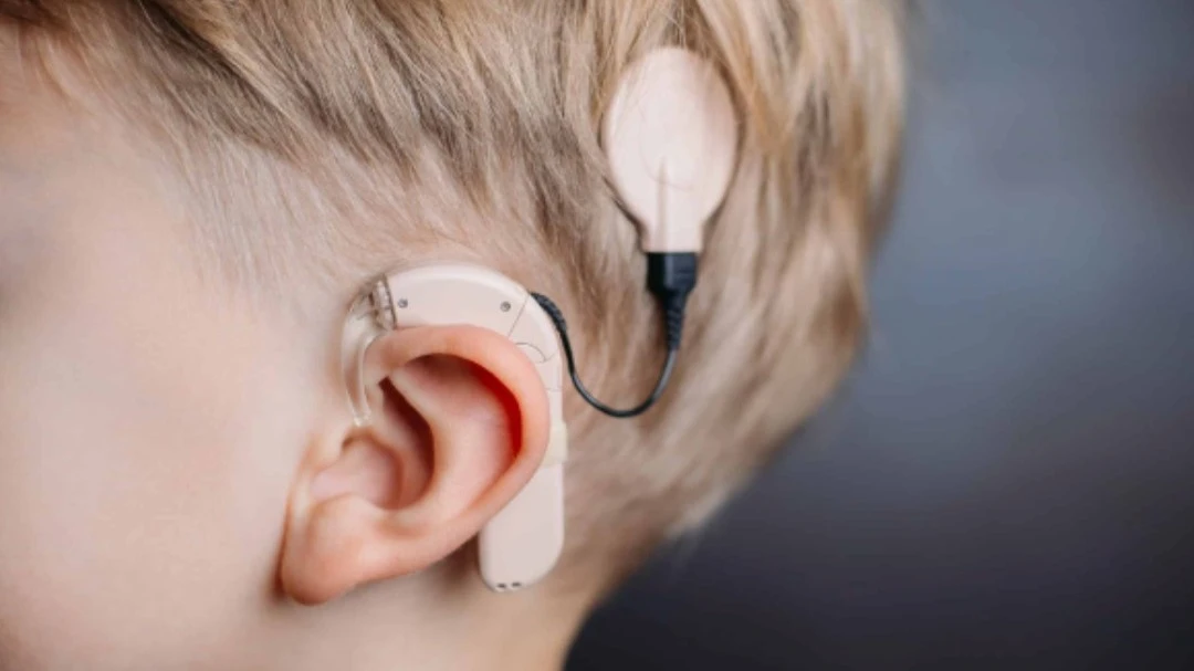 Котировки разработкичка слуховых имплантов обвалились после анонса допэмиссии / Фото: Facebook / EnvoyMedical