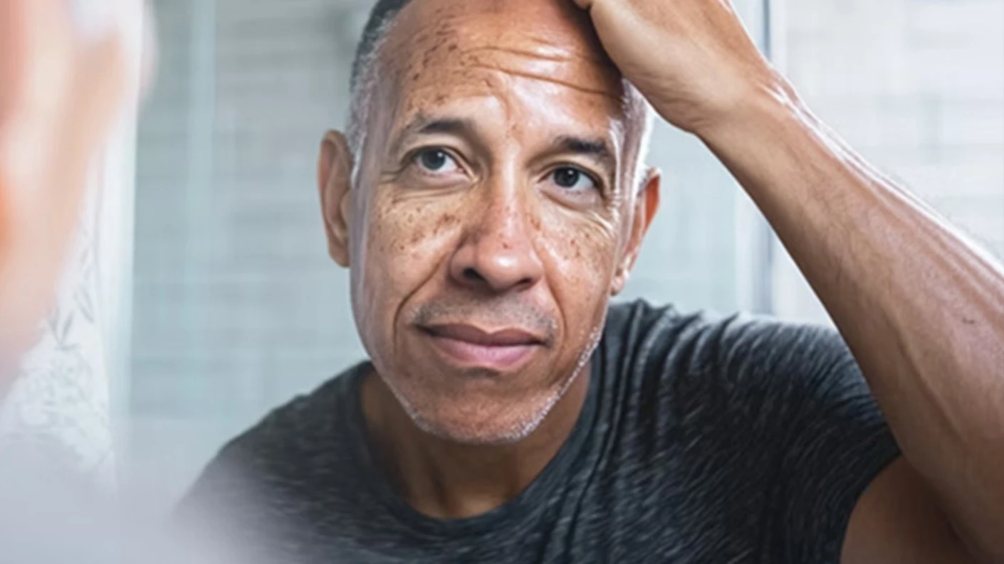 В торговой системе для клиентов Freedom начались предварительные торги Veradermics Therapeutics, — компании, специализирующейся на методах восстановления волос / Фото: Veradermics