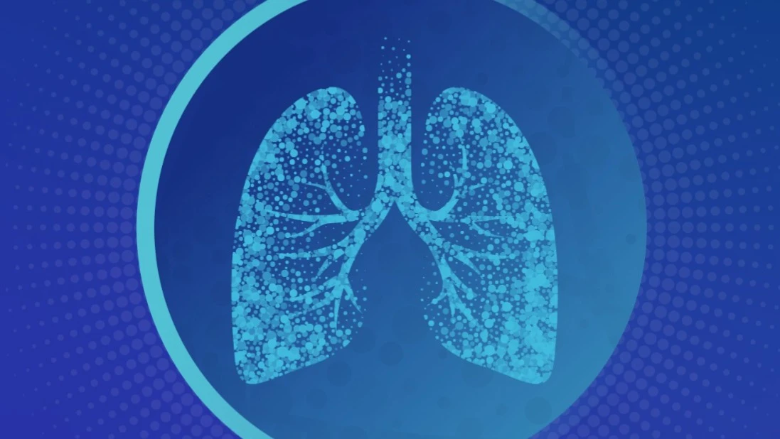 Биотех из Бостона Avalyn Pharma разрабатывает ингаляционные лекарства / Фото: Avalyn Pharma