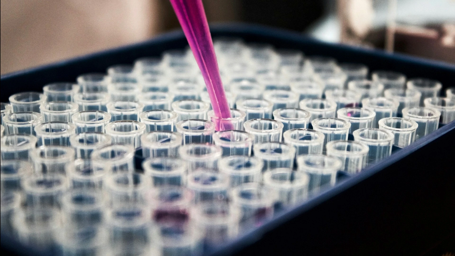 Stanley Druckenmillers Duquesne Family Office has acquired shares in Rhythm Pharmaceuticals, a developer of obesity drugs / Photo: Unsplash/Louis Reed